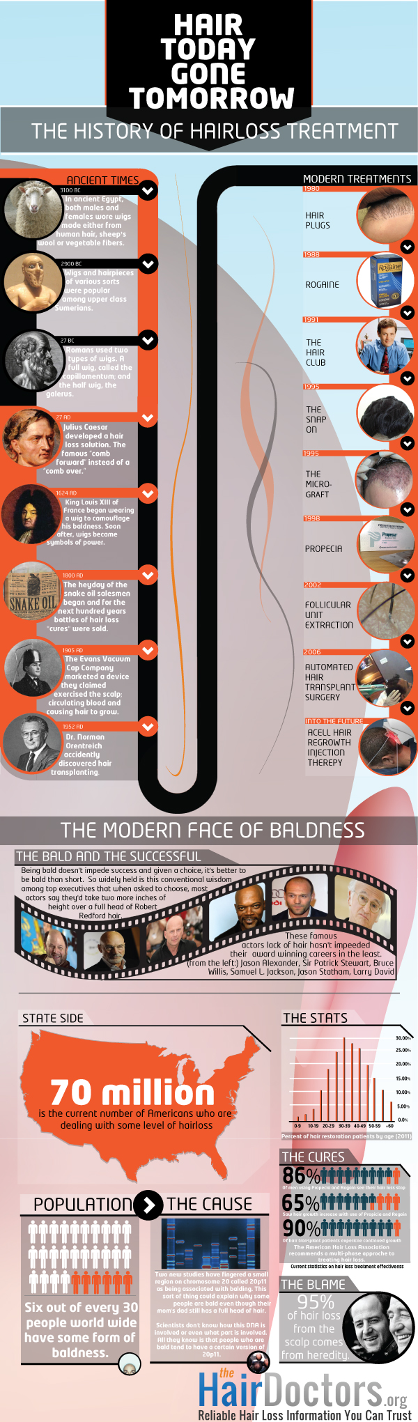 Hair-Loss-Treatment-History-infographic